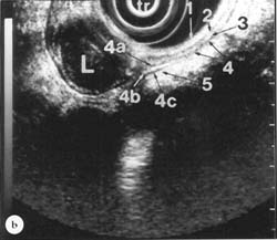 Fig. 13.1b