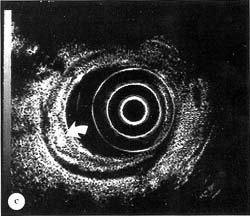 Fig. 13.1c