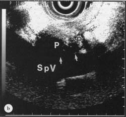 Fig. 13.2B