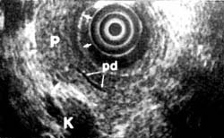 Fig. 10a