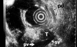 Fig. 10b