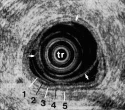 Fig. 1B