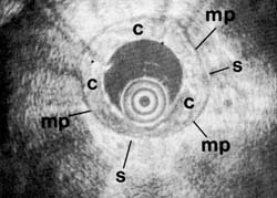 Fig. 1C