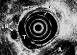 Fig. 2B