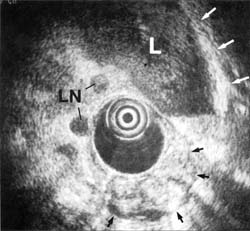 Fig. 5c