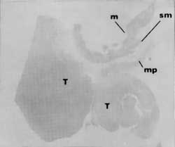 Fig. 9b